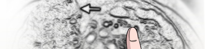 A.I Doctor Chapter 08 Gambar 19