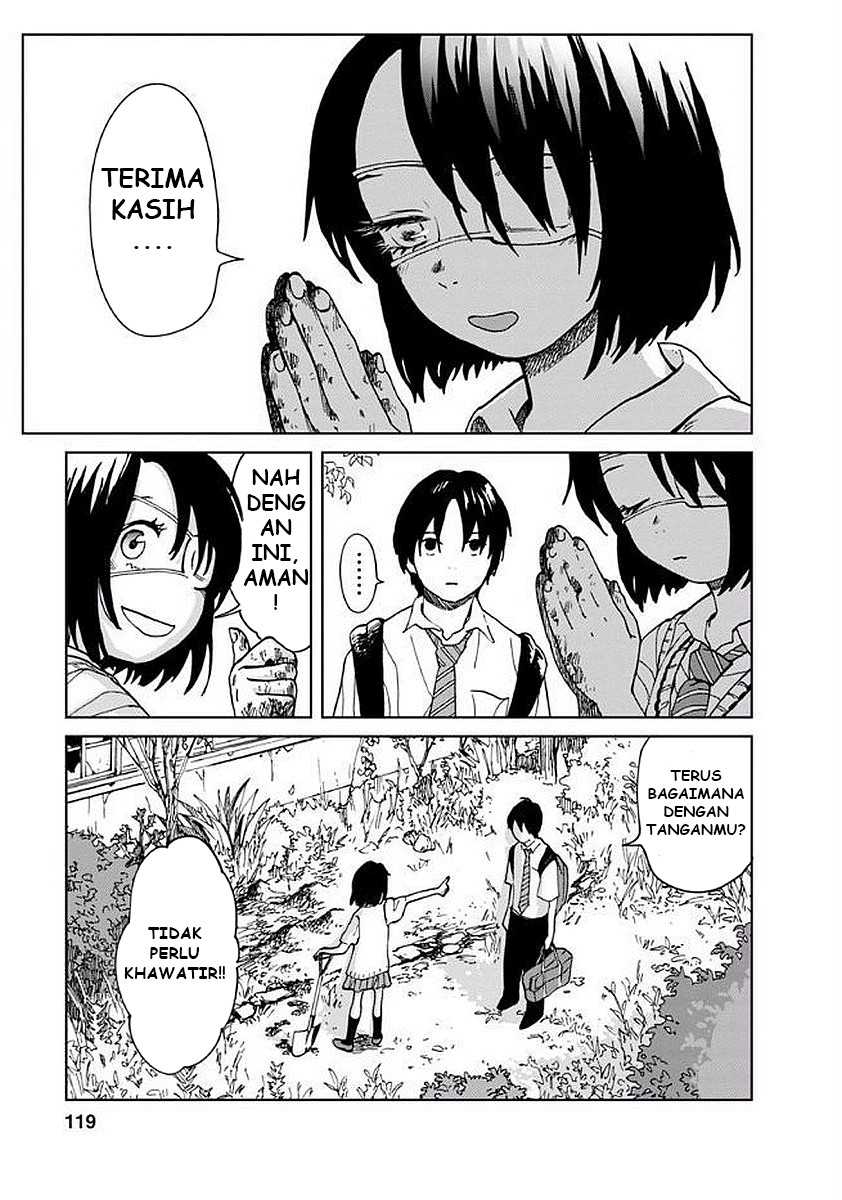 Yakedo Shoujo Chapter 05 Gambar 4