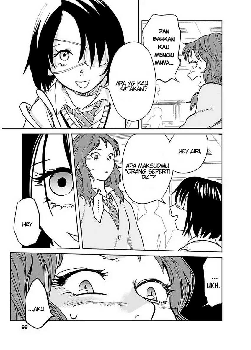 Yakedo Shoujo Chapter 04 Gambar 9