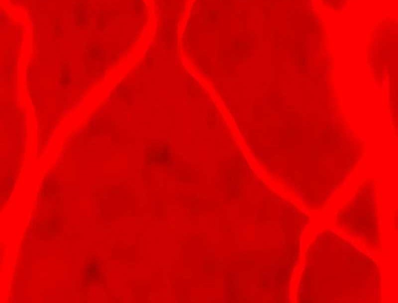 Bones Chapter 15 Gambar 46